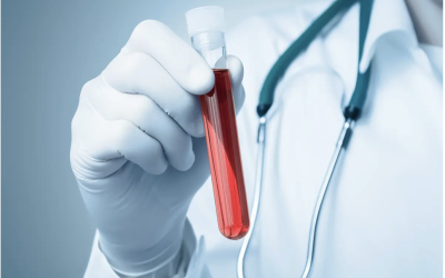 New Blood Test 91 Percent Accurate for Detecting Chronic Fatigue Syndrome